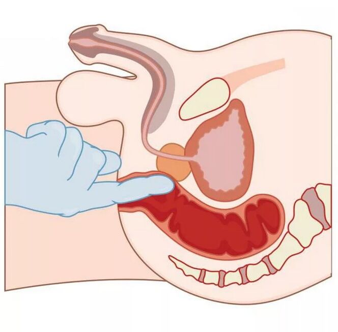 Мужчынскае размяшчэнне кропкі G